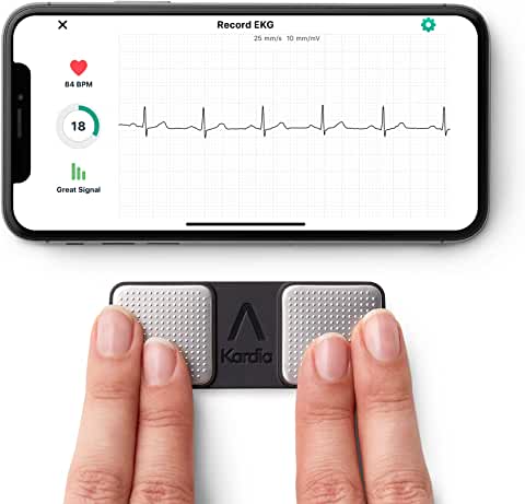EKG monitor